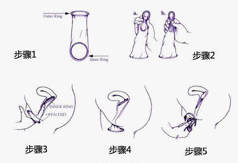 女用避孕套真人演示大图（视频）【组图详解】