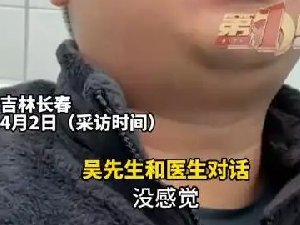 嘴唇发紫博主被粉丝隔空诊出心脏病