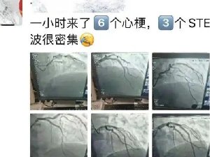 三甲医院专家感慨1小时来了6个心梗